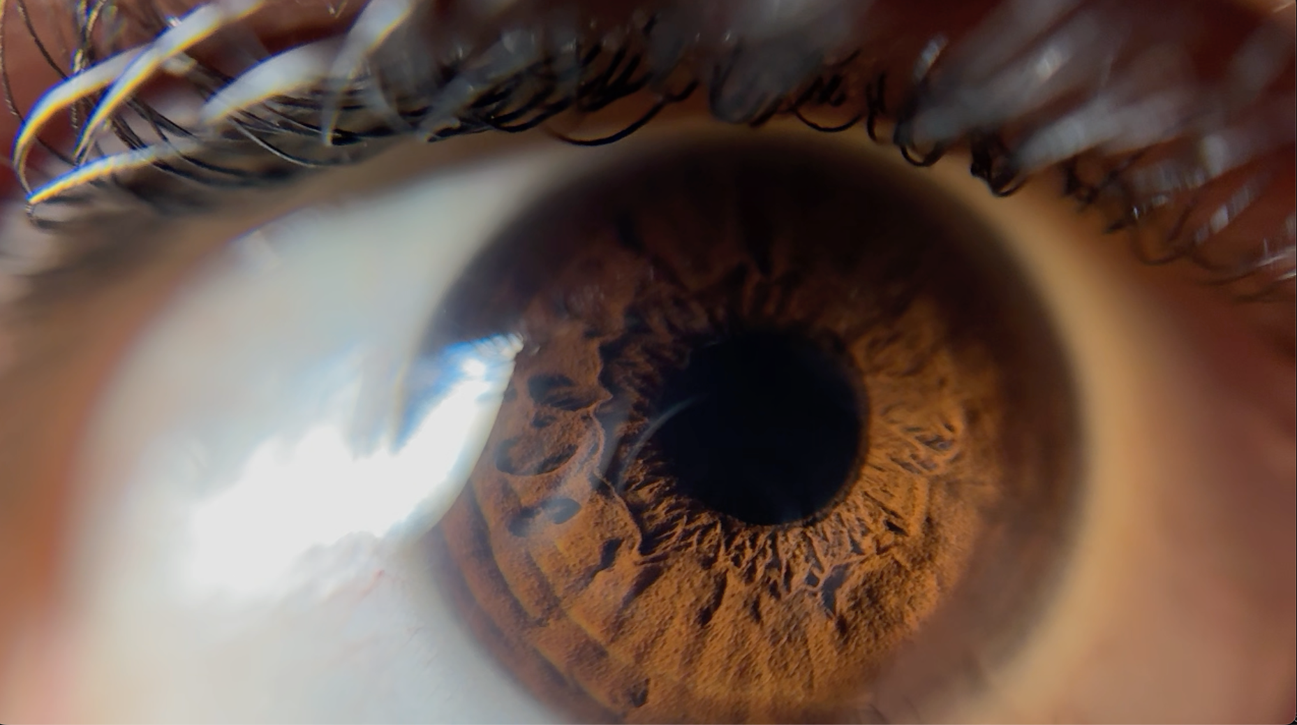 iPhone macro photo of an eye